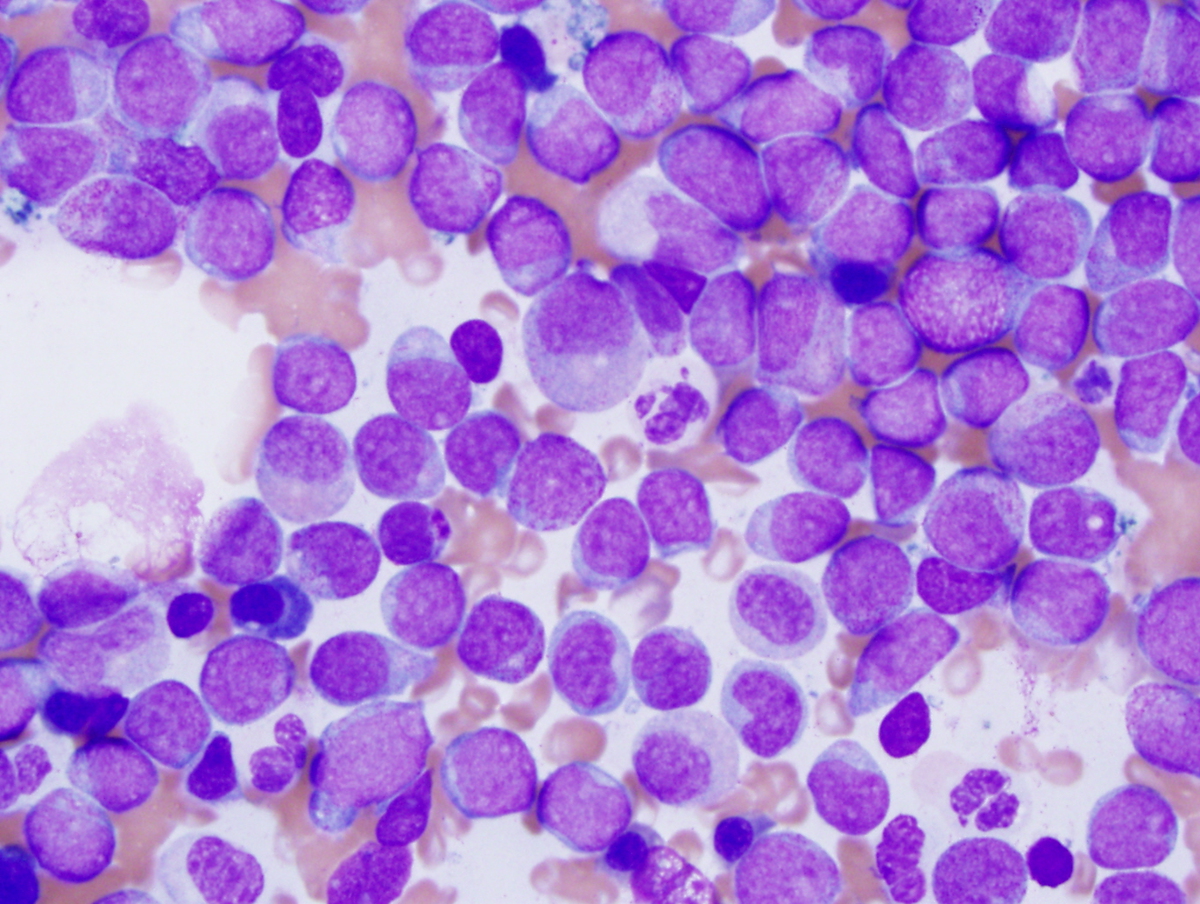 Bone marrow aspirate